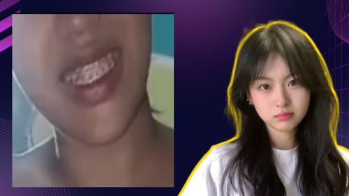 pcr temen